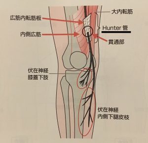 ハンター管の図